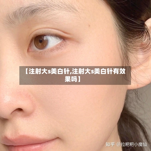 【注射大s美白针,注射大s美白针有效果吗】-第2张图片