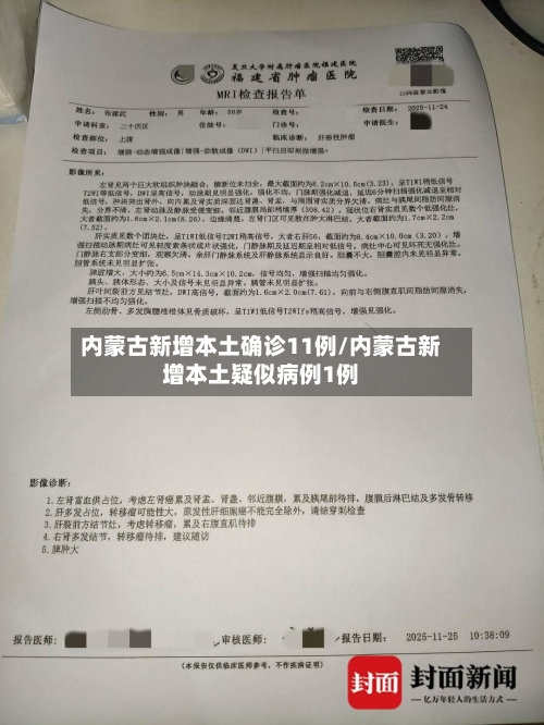 内蒙古新增本土确诊11例/内蒙古新增本土疑似病例1例-第2张图片