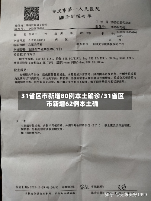 31省区市新增80例本土确诊/31省区市新增62例本土确-第2张图片
